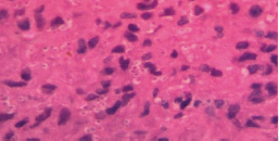 hematoxylin and eosin (H&E) stain 